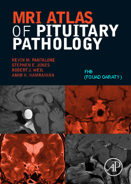 MRI ATLAS OF PITUITARY PATHOLOGY