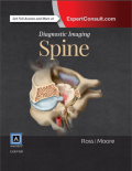 Diagnostic Imaging: Spine, Third Edition