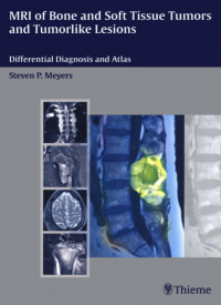 MRI of Bone and Soft Tissue Tumors and Tumorlike Lesions: Differential Diagnosis and Atlas