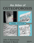 AN ATLAS OF OSTEOPOROSIS