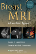 Breast MRI : a Case-Based Approach