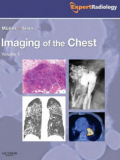 Imaging of the Chest Volume I