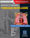 Specialty Imaging: Thoracic Neoplasm