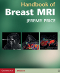 Handbook of Breast MRI